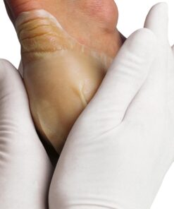 Alternative view of Hydrocoll Thin (Similar to Granuflex) Hydrocolloid Dressing 10cm x 10cm (Singles)